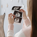 Patologie rare, donna di Nocera Inferiore dà alla luce neonato con aneurisma della vena ombelicale 